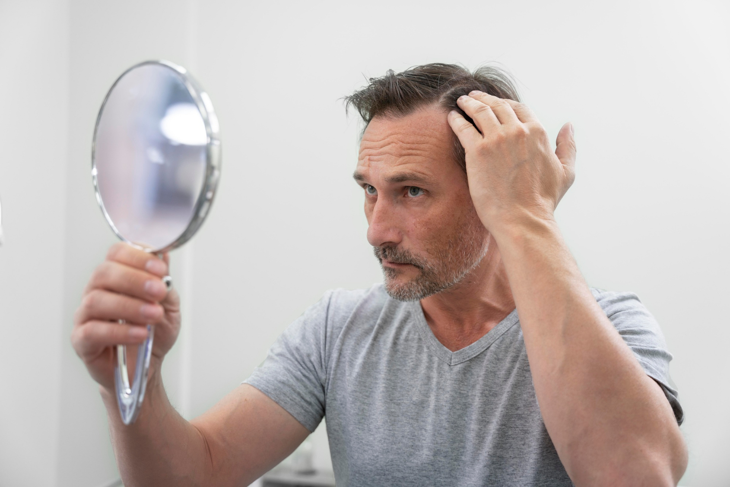 Calvície Masculina: Causas e Tratamentos Comprovados